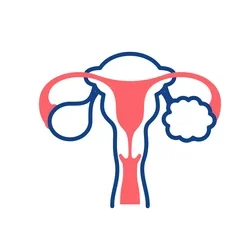 PCOD/PCOS